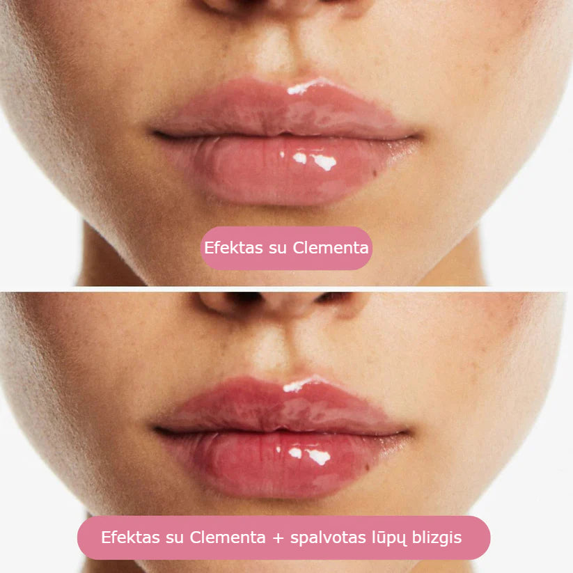 Clementa lūpų putlintojas